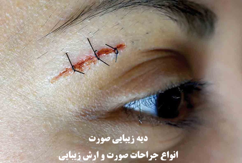 دیه زیبایی صورت ۱۴۰۴