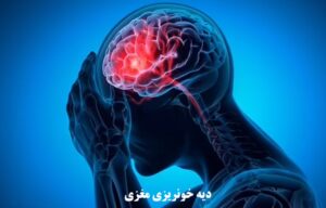 دیه خونریزی مغزی در سال ۱۴۰۴