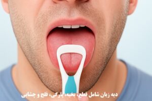 دیه زبان در سال ۱۴۰۴ شامل قطع، بخیه، پارگی، فلج و چشایی