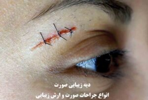 دیه زیبایی صورت ۱۴۰۴