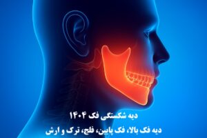 دیه شکستگی فک ۱۴۰۴