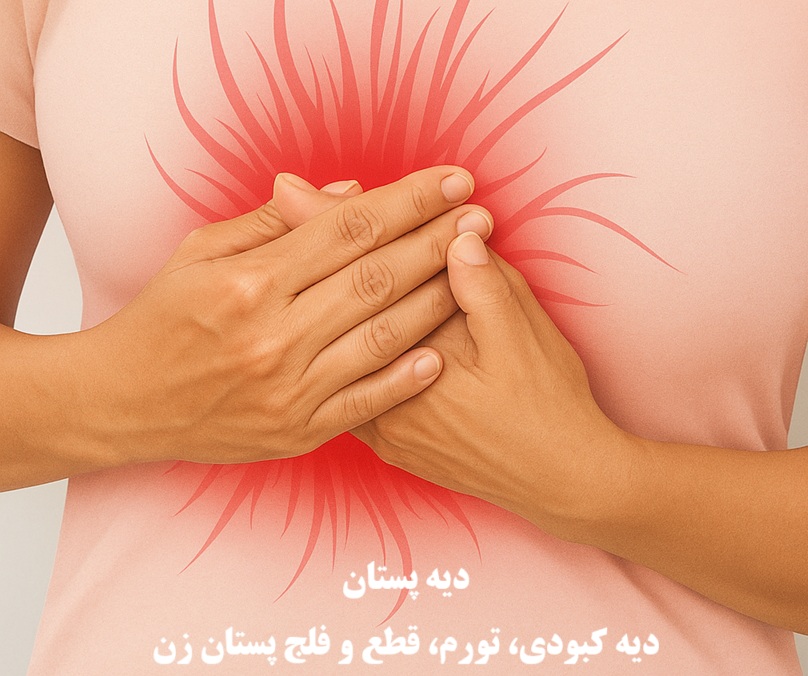 دیه پستان ۱۴۰۴