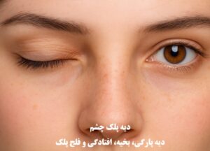 دیه پلک چشم در سال ۱۴۰۴