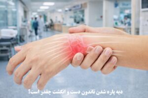 دیه پاره شدن تاندون دست و انگشت چقدر است؟